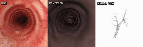 Animated GABL localization result showing RGB input, rendered airway view, and global camera position