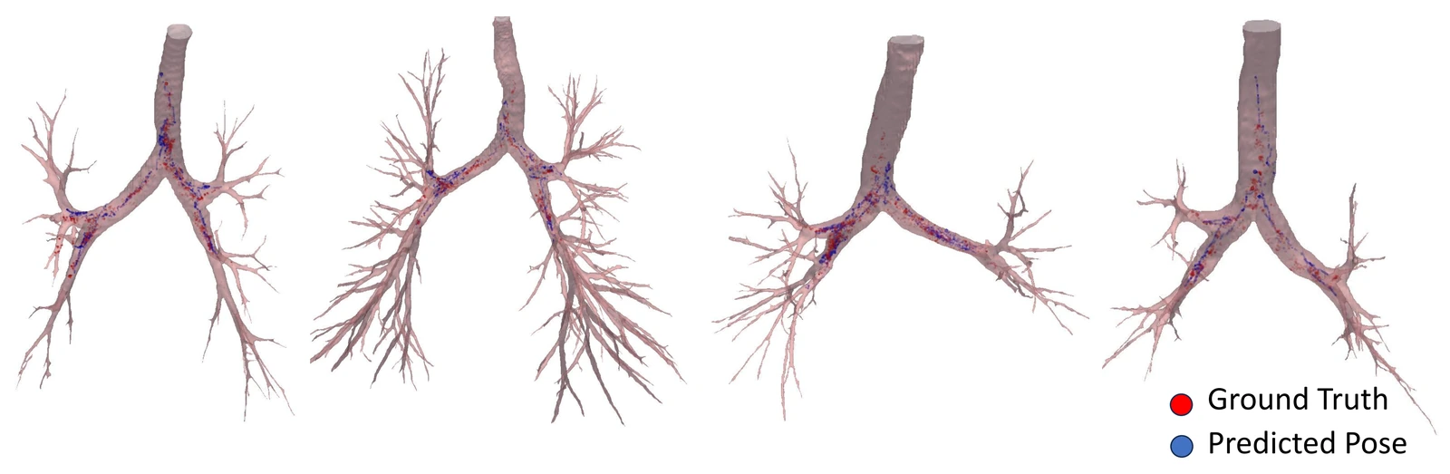 Ground-truth and predicted bronchoscope trajectories overlaid on three airway models